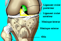 PROTHESE UNICOMPARTIMENTALE INTERNE