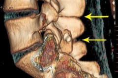 vue 3D de profil du DIAM